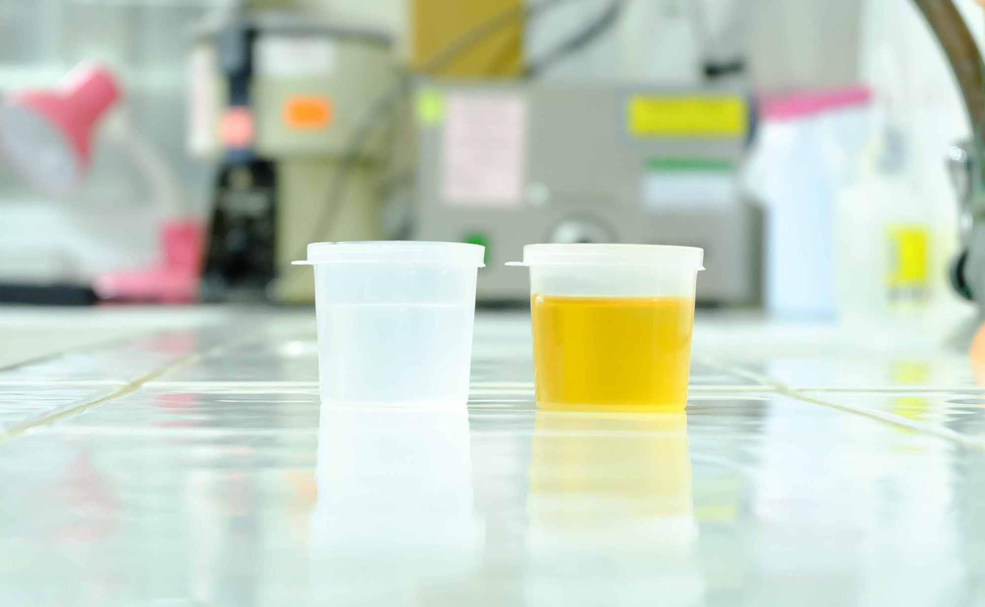 搜狐:管家婆一肖一码资料大全-尿液发黄是什么原因  第1张