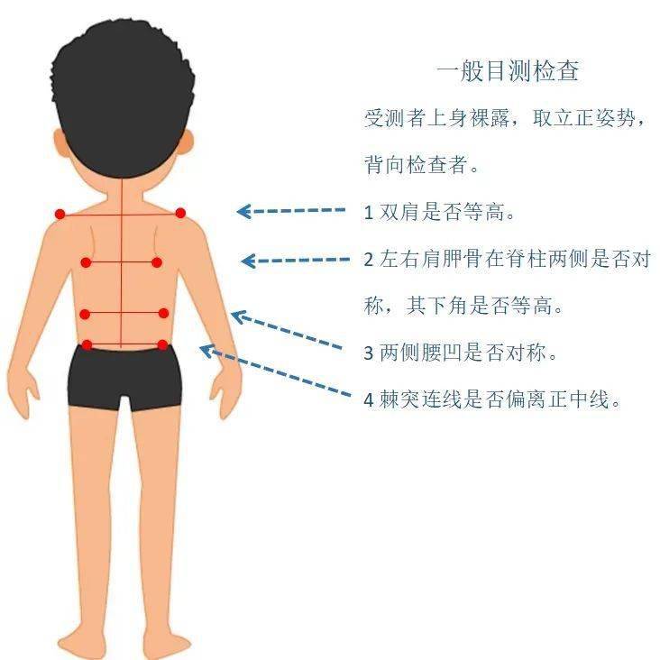 搜狗订阅:管家婆一肖-一码-一中一特-医生呼吁普及中小学生脊柱侧弯筛查  第2张
