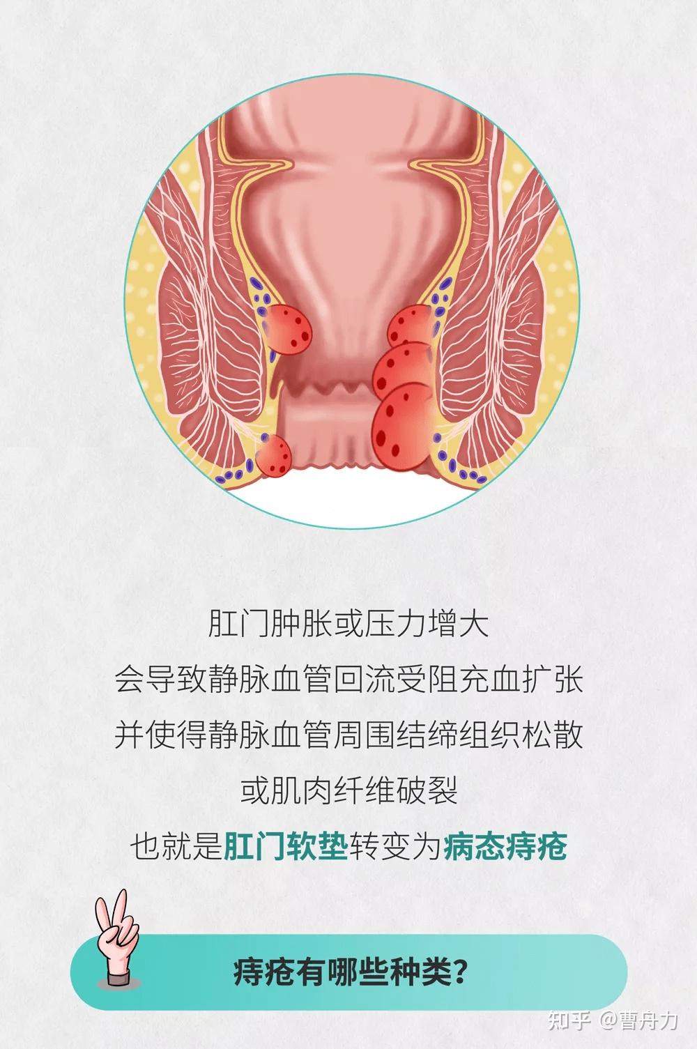 中新网:新澳门王中王资料-什么叫痔疮  第1张