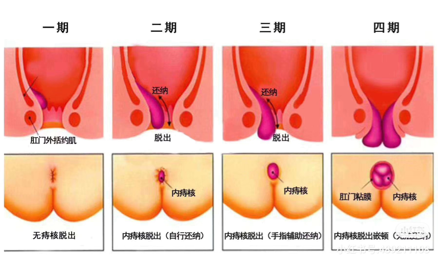 中新网:新澳门王中王资料-什么叫痔疮  第3张