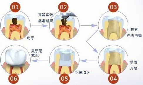 百度平台:白小姐一肖一码100正确-什么是根管治疗  第1张