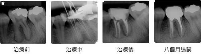 百度平台:白小姐一肖一码100正确-什么是根管治疗  第3张