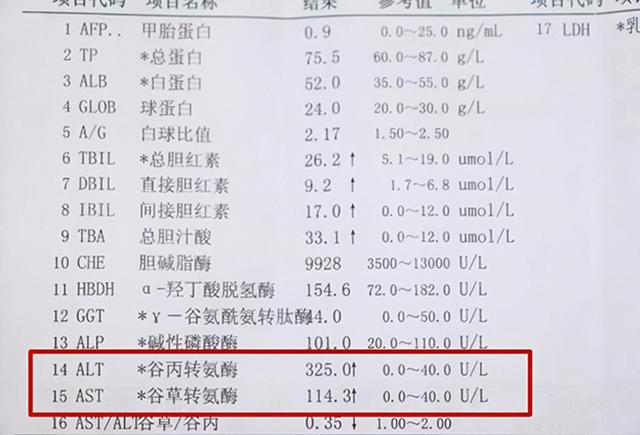 百度平台:2024正版资料大全免费-谷草谷丙偏高是什么意思  第2张