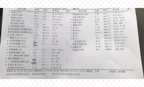 百度平台:2024正版资料大全免费-谷草谷丙偏高是什么意思  第1张