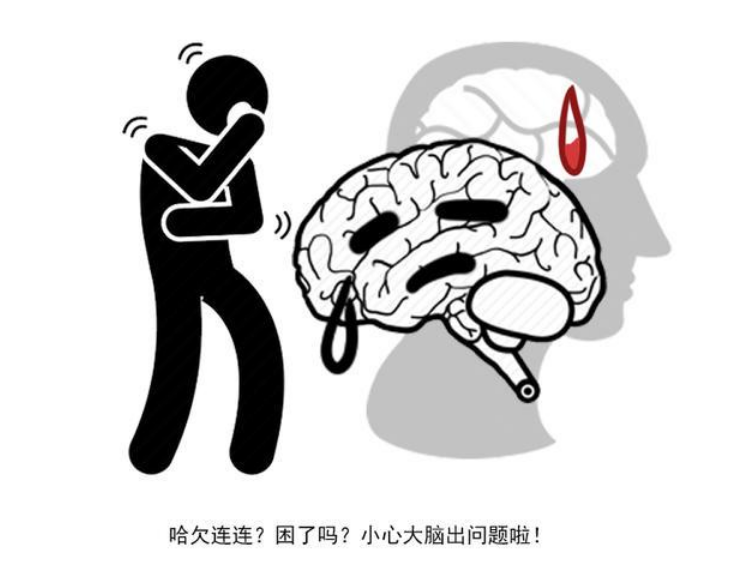 网易:2024澳门资料大全免费图片-脑梗的前兆是什么  第3张